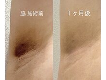 オリ('OLI)