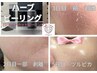 【新導入キャンペーン】剥離(有り)ハーブピーリング 今だけお得に　18000→