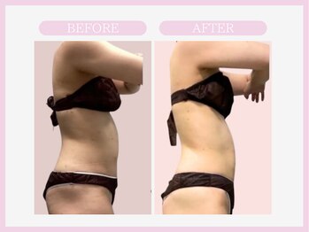 スリムライン 山形店(The Slim Line)/before→after