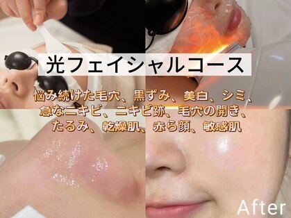 スターズ(Stars)の写真