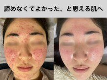 リリアス(RILLIAS)