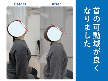 琴似じんぼ整体院/肩こり、整体後の変化