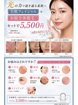 アーユス 健軍店(Ayus)の写真/お顔脱毛も光フェイシャルも同時に！
