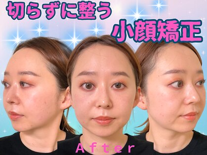 ナチュラルパーフェクトフェイス 新宿の写真