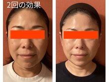 ロイヤリティ(ROYALTY)/気になる悩みをカスタマイズ施術