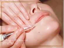 アン グレーヌ 自由が丘(unegraine)の雰囲気（諦めていた大人のお肌悩みも徹底的に改善[自由が丘/小顔/毛穴]）