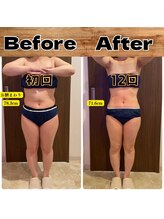 あきくに整骨院 美容整体院/M様ビフォーアフター