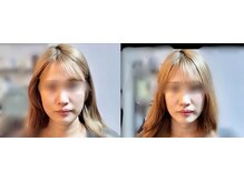 一樹鍼灸院/美容鍼灸