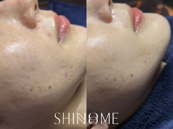 シノノメ(SHINONOME)/*あかみ