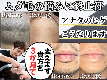 レイ(R.E.I)/ムダ毛の悩みに終止符を