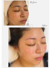 エリス(ELISSE)/肌も眉も綺麗を叶えるサロン