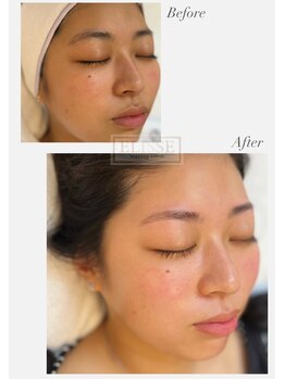 エリス(ELISSE)/肌も眉も綺麗を叶えるサロン