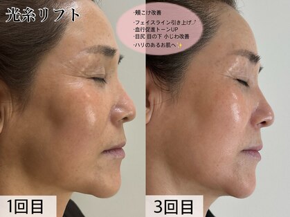ウィ アネラ(U'i Anela)の写真
