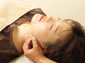 鍼灸院 虹の写真/結果にこだわり、ご満足いただけるよう徹底施術!高技術の美容鍼は困った時の駆け込み寺にもオススメ♪