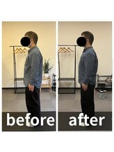 カワル整体 長嶺院/巻き肩&猫背