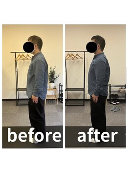 カワル整体 長嶺院/巻き肩&猫背