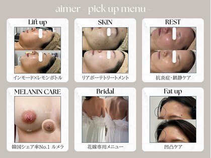 エメ(aimer)の写真