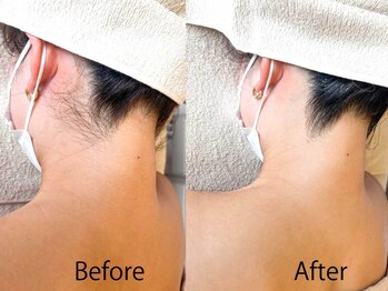 ライトウェーブ 松本村井本店/えり足ビフォーアフター