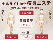 ラ パルレ 大宮本店/全身セルライトケア