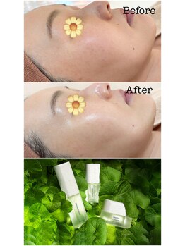 エクラ(eclat)/プレミアムケア