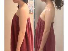 ロココ 錦糸町店(Rococo)/比較写真