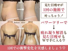 クイーンズチャーム(Queen's Charm)