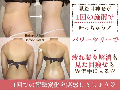 クイーンズチャーム(Queen's Charm)の写真