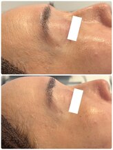 グラサヴォーグ 金沢店/50代女性