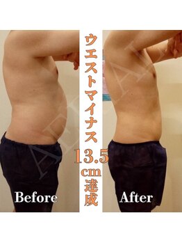 エアリアル 八女店/男性のぽっこりお腹も！！