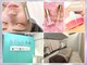 ベルラ(BELLRA)の写真