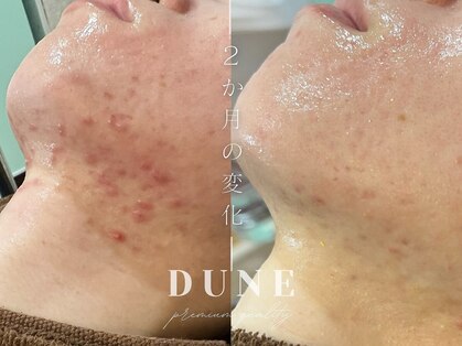 デューン 蕨店(Dune)の写真