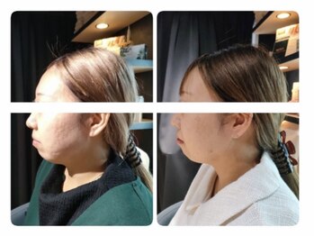 ソラ(sola*)/レモンボトル