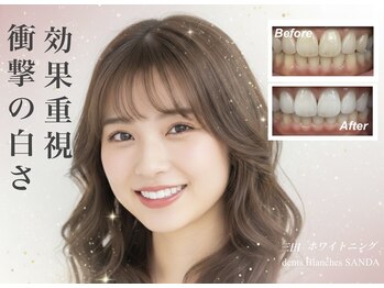 ダンブランシュサンダ(dents Blanches SANDA)/dents Blanches SANDA(三田市)