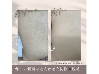 モアトゥインクル 福山宮通り店(MORE twinkle)の写真