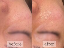 グランビューティ(Glanz Beauty)/30代男性