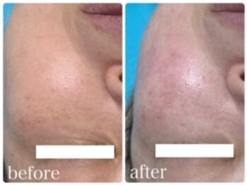 エクラニーク(Eclanique)/まさに透明感爆上げ！☆