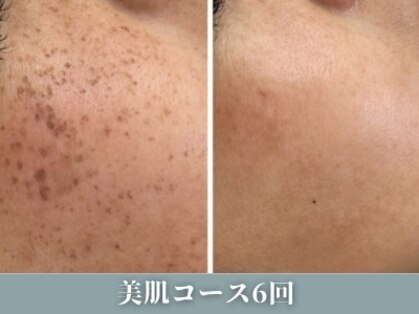 アンドユー(and.yu)の写真