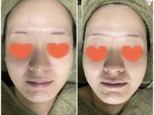 ビーナイス ビューティー(Be Nice Beauty)/