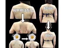 スワン 新栄店(SWAN)/☆結果重視salon☆Before After