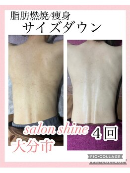 サロンシャイン(Salon Shine)/痩身マッサージ4回