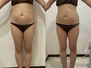 サクラ スパ(SAKURA SPA)/筋膜リリース