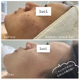 ビューティ スペース ルーチ(beauty space Luci)