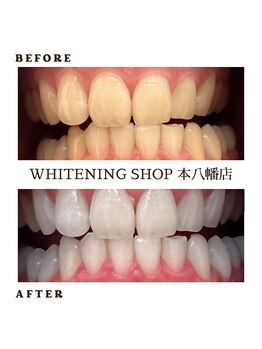 ホワイトニングショップ 本八幡店/歯科提携　ホワイトニング専門店