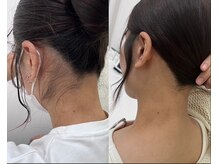 ミース 江坂店/うなじ●ビフォーアフター