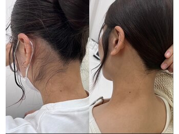 ミース 江坂店/うなじ●ビフォーアフター