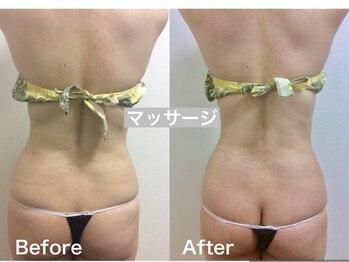 Hb 与野/更年期オイルマッサージ