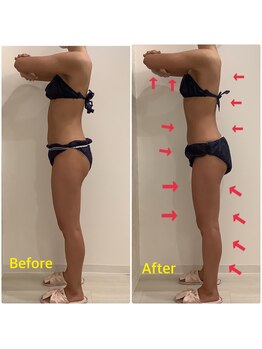 スペチアーレ 夙川/お正月の浮腫み解消