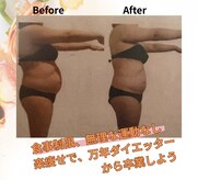 ヨサパーク ヴァーチュ(YOSA PARK Vertue)