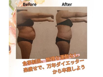 ヨサパーク ヴァーチュ(YOSA PARK Vertue)の写真