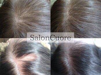 salon cuore【LEDマツエク/増毛エクステ/まつげパーマ】の写真/試しにやってみた方のほとんどがリピート!頭部の髪の毛増毛エクステで理想の自分へ☆